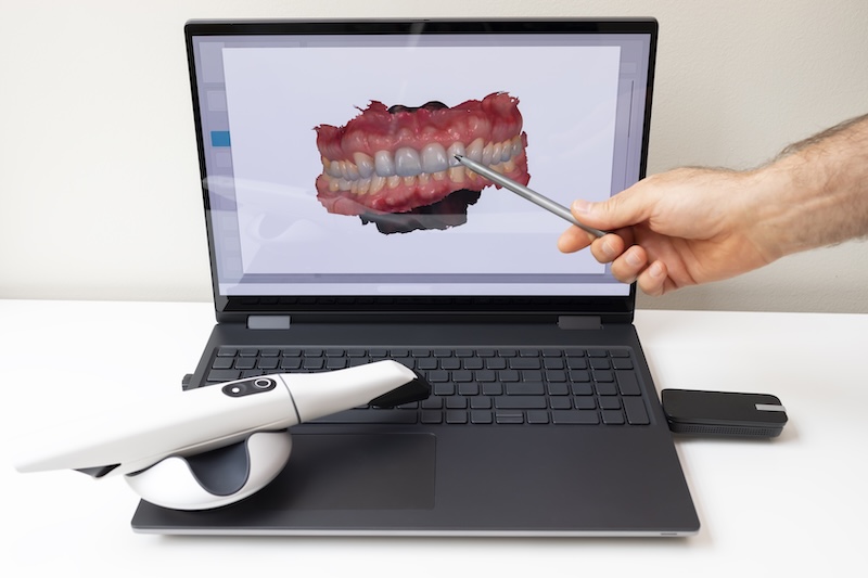 What Is a Periodontist?